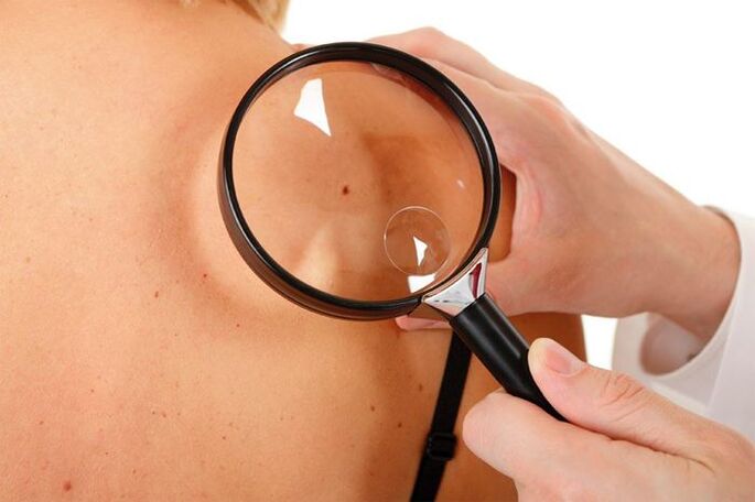 Изследване на пациент с HPV